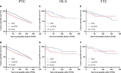 Radioactive iodine therapy strategies for distinct types of differentiated thyroid cancer: a propensity score–matched analysis